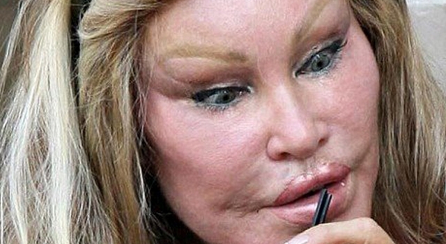 Jocelyn-Wildenstein-surprised-or-frightened