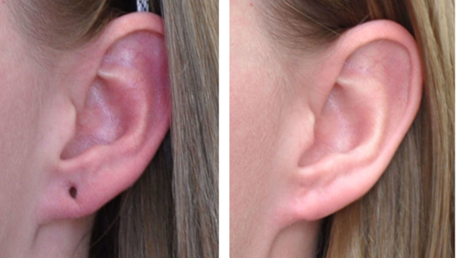 Ear plugs stretchers and avoiding the pitfalls Gothic Angel Clothing